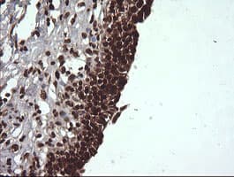 VHL / Von Hippel Lindau Antibody (clone OTI1E1)