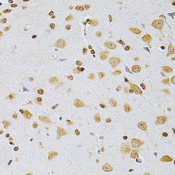 MDM2 Antibody