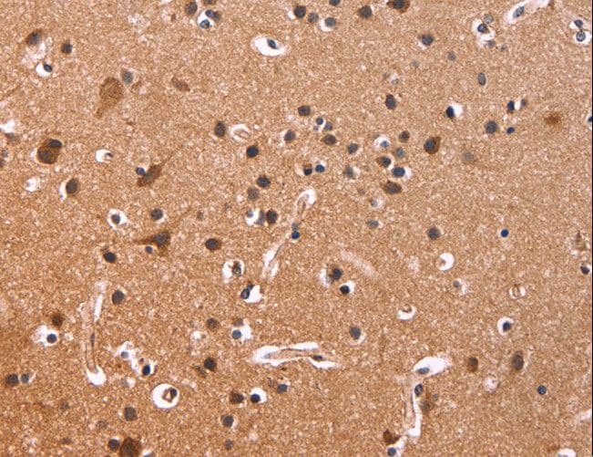 CSNK1D Antibody