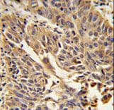 Polyclonal Rabbit anti-Human JUP/CTNNG/Junction Plakoglobin Antibody (aa636-663, IHC, WB)