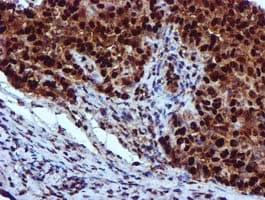 Monoclonal Mouse anti-Human EPM2AIP1 Antibody (clone OTI2A2, IHC, WB)