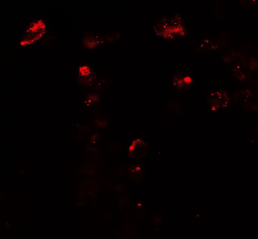 IHC-plus™ Polyclonal Rabbit anti-Human UNG / Uracil DNA Glycosylase Antibody (IHC, IF, WB)