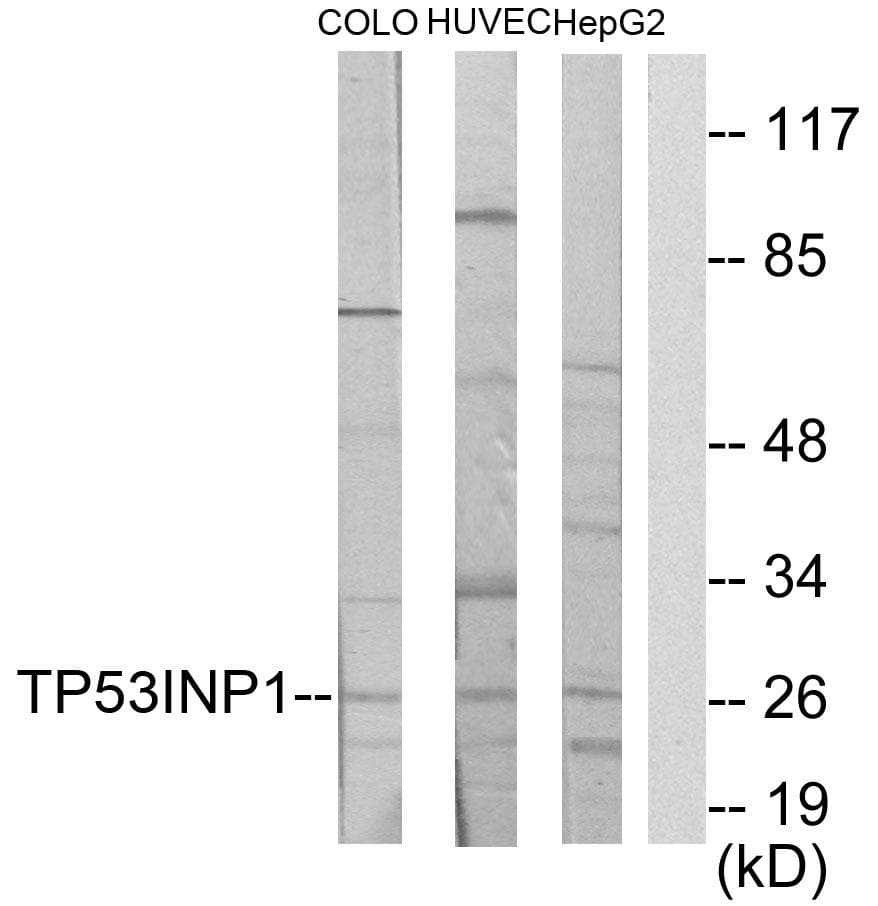 SIP / TP53INP1 Antibody