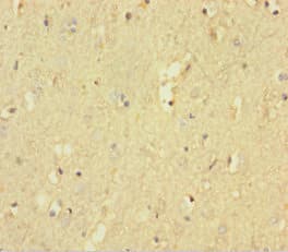 PTPRZ1 / Phosphacan Antibody (aa36-300)
