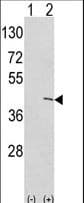 ETNK1 / Ethanolamine Kinase 2 Antibody (aa1-30)