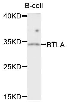Polyclonal Rabbit anti-Human BTLA / CD272 Antibody (WB)
