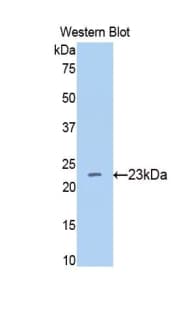 BACE1 / BACE Antibody (aa181-366, Biotin)