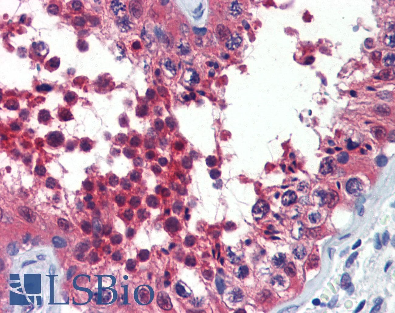 IHC-plus™ Polyclonal Rabbit anti-Human HSP40 Antibody (IHC, WB)