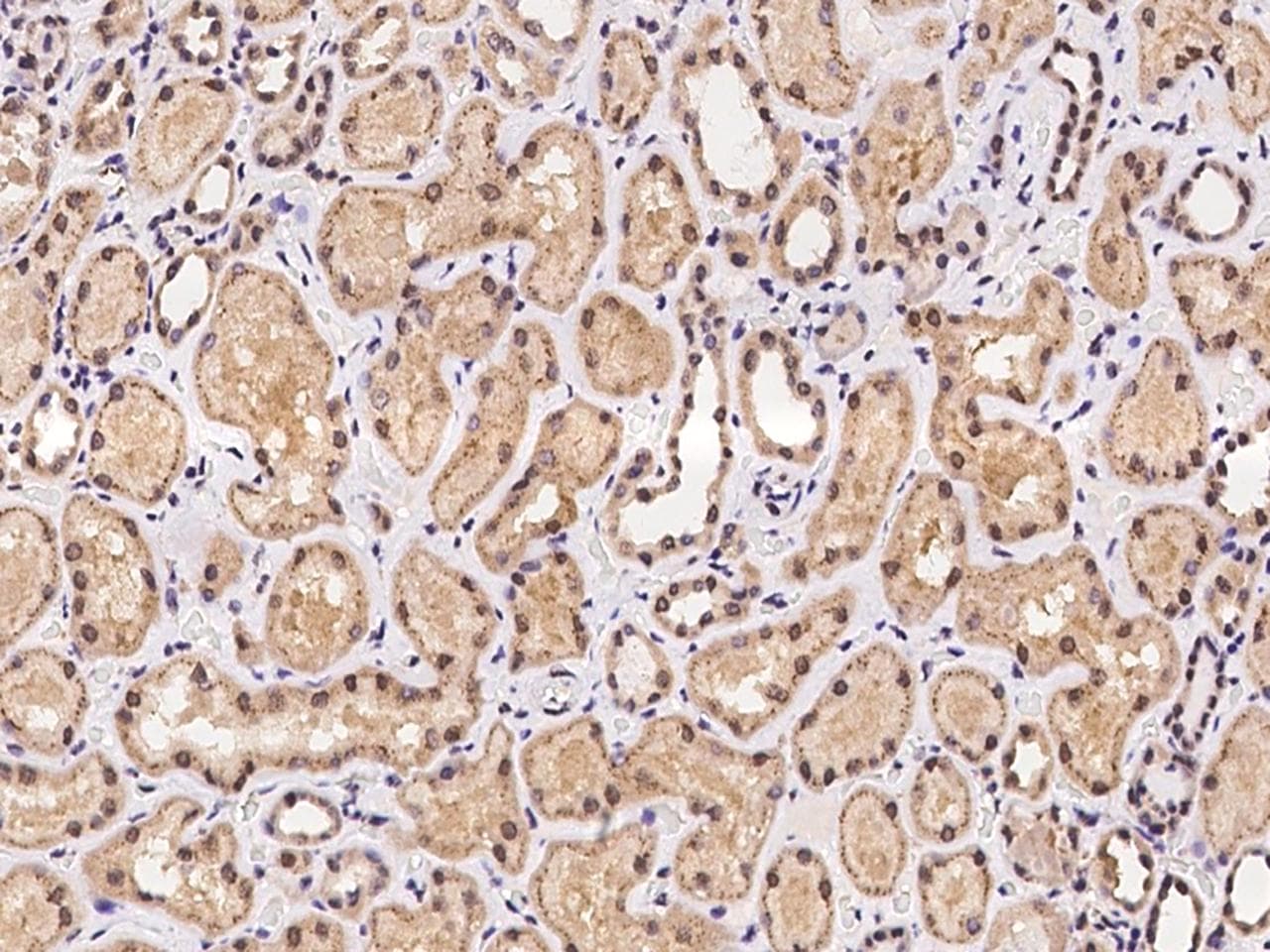 Polyclonal Rabbit anti-Human C5orf24 Antibody (IHC)