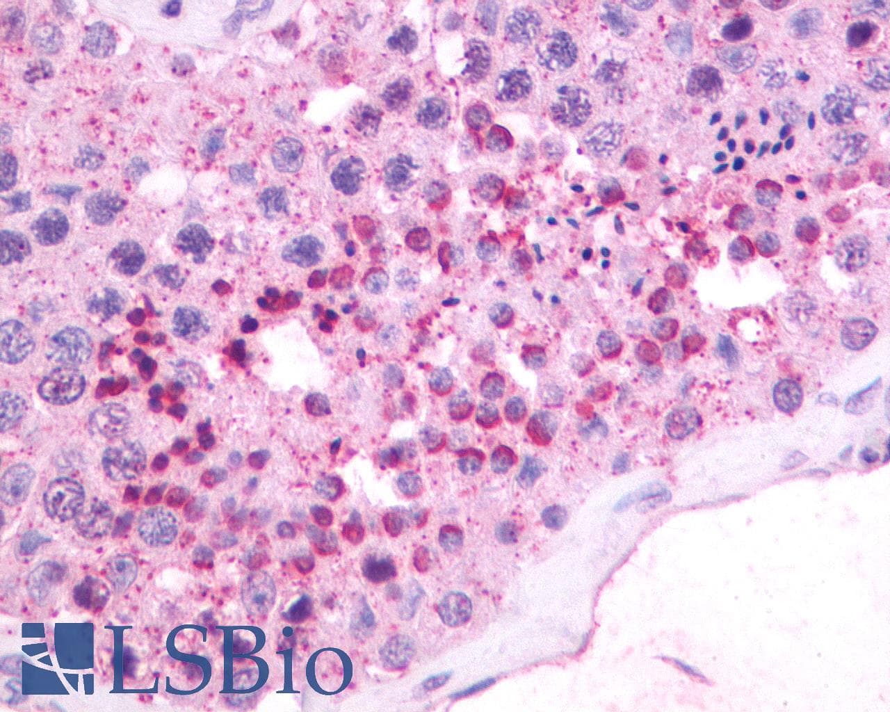 PathPlus™ NMBR Antibody (Cytoplasmic Domain)