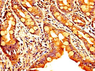 Polyclonal Rabbit anti-Human SEMA4B / Semaphorin 4B Antibody (IHC, WB)