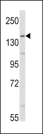 AOX1 / Aldehyde Oxidase Antibody (aa698-726)