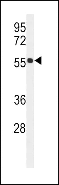 IHC-plus™ HIAT1 Antibody (aa454-483)