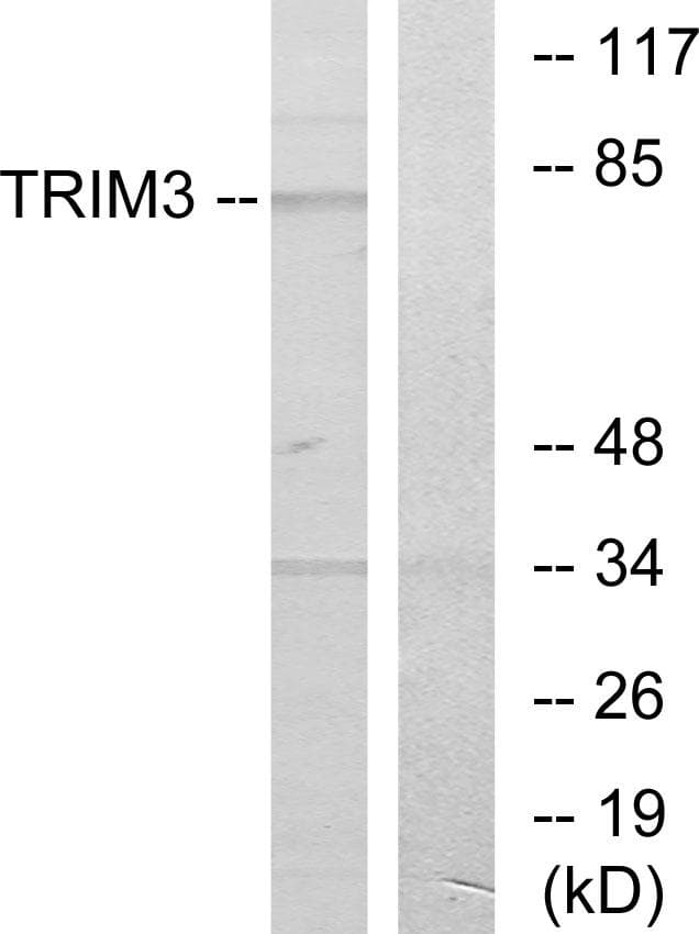 TRIM3 Antibody