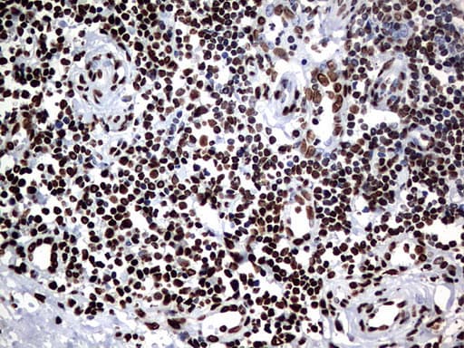 HNRPM / HNRNPM Antibody (aa1-261, clone OTI6H7)