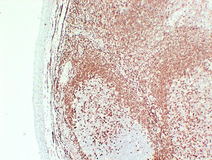 CDKN1B / p27 Kip1 Antibody (clone ABT-p27)