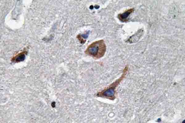Polyclonal Rabbit anti-Human IL12A / p35 Antibody (Thr65, IHC, WB)