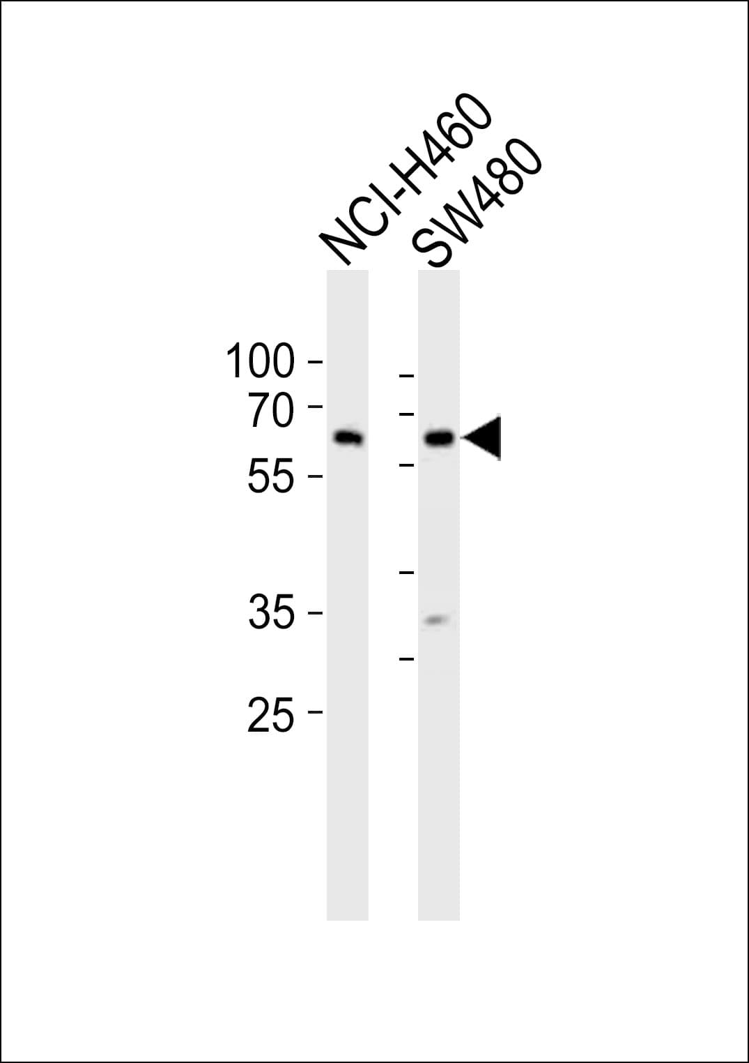 PPP2R1B Antibody (aa5-37)