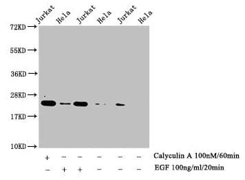 HIST1H1E Antibody (phospho-Thr17)