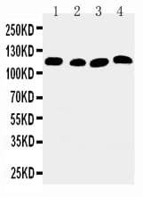 ATP2A2 / SERCA2 Antibody (aa665-679)