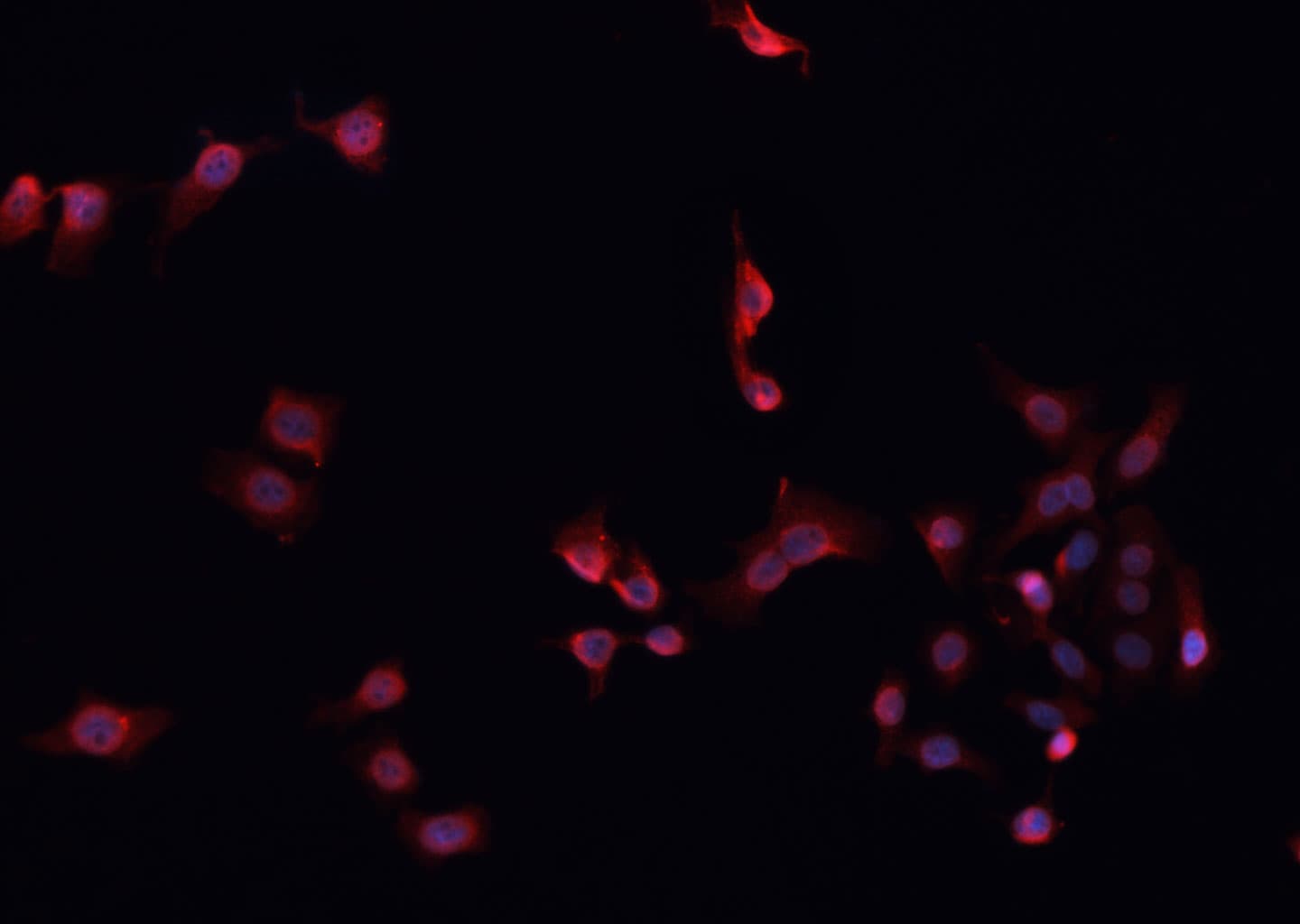 FOXP3 Antibody