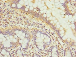 Polyclonal Rabbit anti-Human GALNT3 Antibody (IHC)