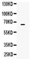 Polyclonal Rabbit anti-Human ST7 Antibody (WB)