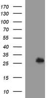 Monoclonal Mouse anti-Human DTD1 Antibody (clone OTI1E1, IF, WB)