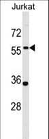 PANX1 / Pannexin 1 Antibody (aa124-152)