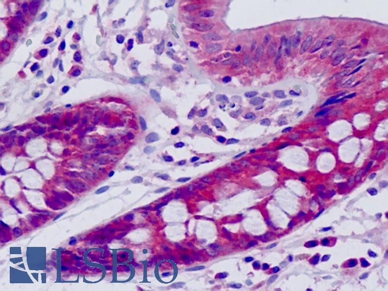 IHC-plus™ Polyclonal Rabbit anti-Human HARS Antibody (aa460-509, IHC, IF, WB)