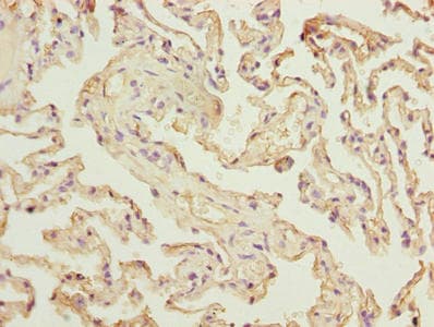 Polyclonal Rabbit anti-Human RAD23A / HHR23A Antibody (IHC, WB)