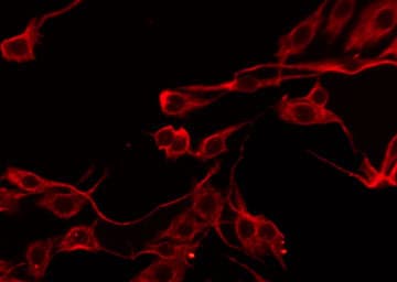 SERPINB5 / Maspin Antibody
