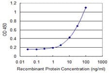 DCK / Deoxycytidine kinase Antibody (clone 1E7)