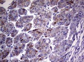 Monoclonal Mouse anti-Human CD30 Antibody (clone OTI3B5, aa19-379, IHC, WB)
