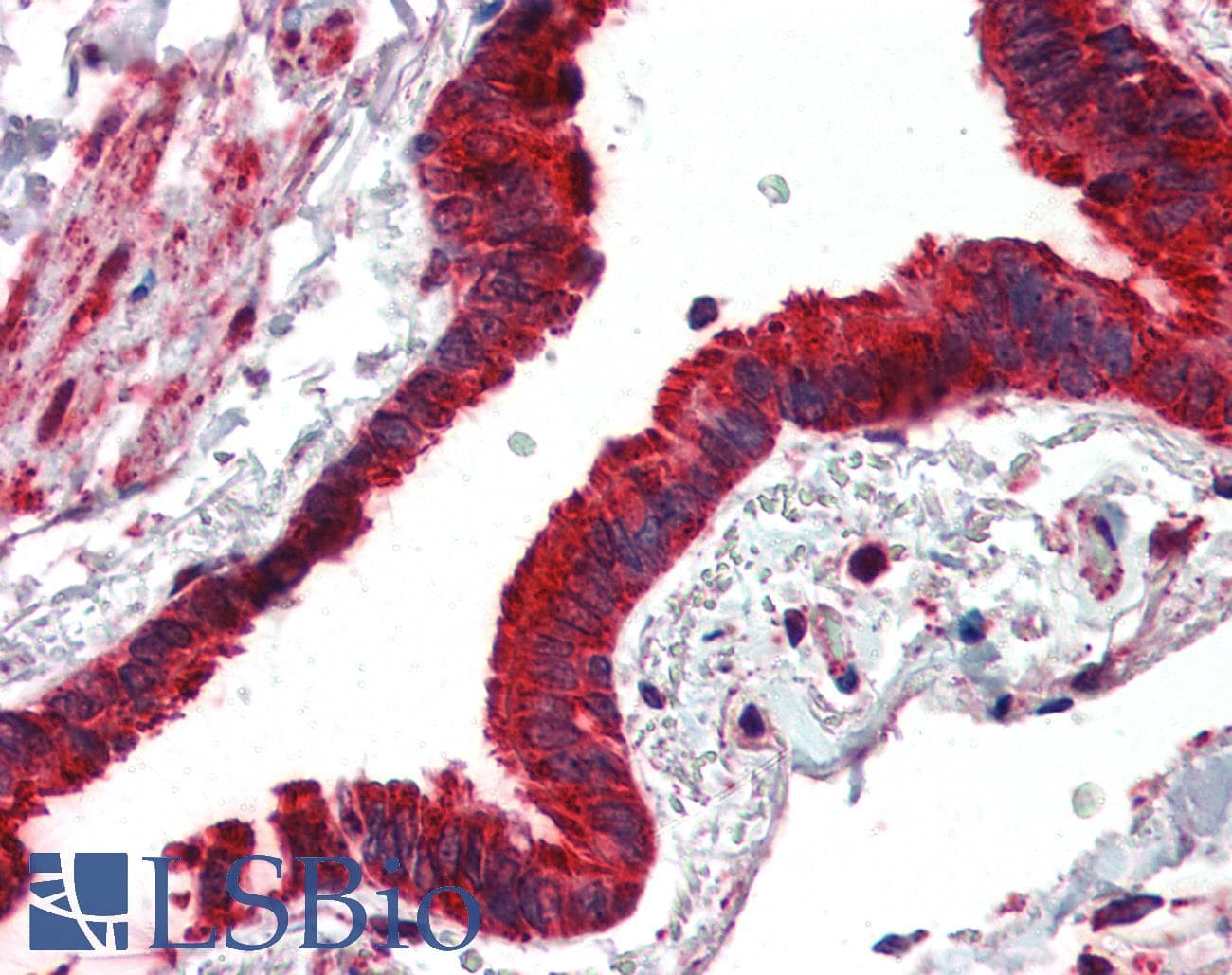 IHC-plus™ MMP14 Antibody (aa160-173)