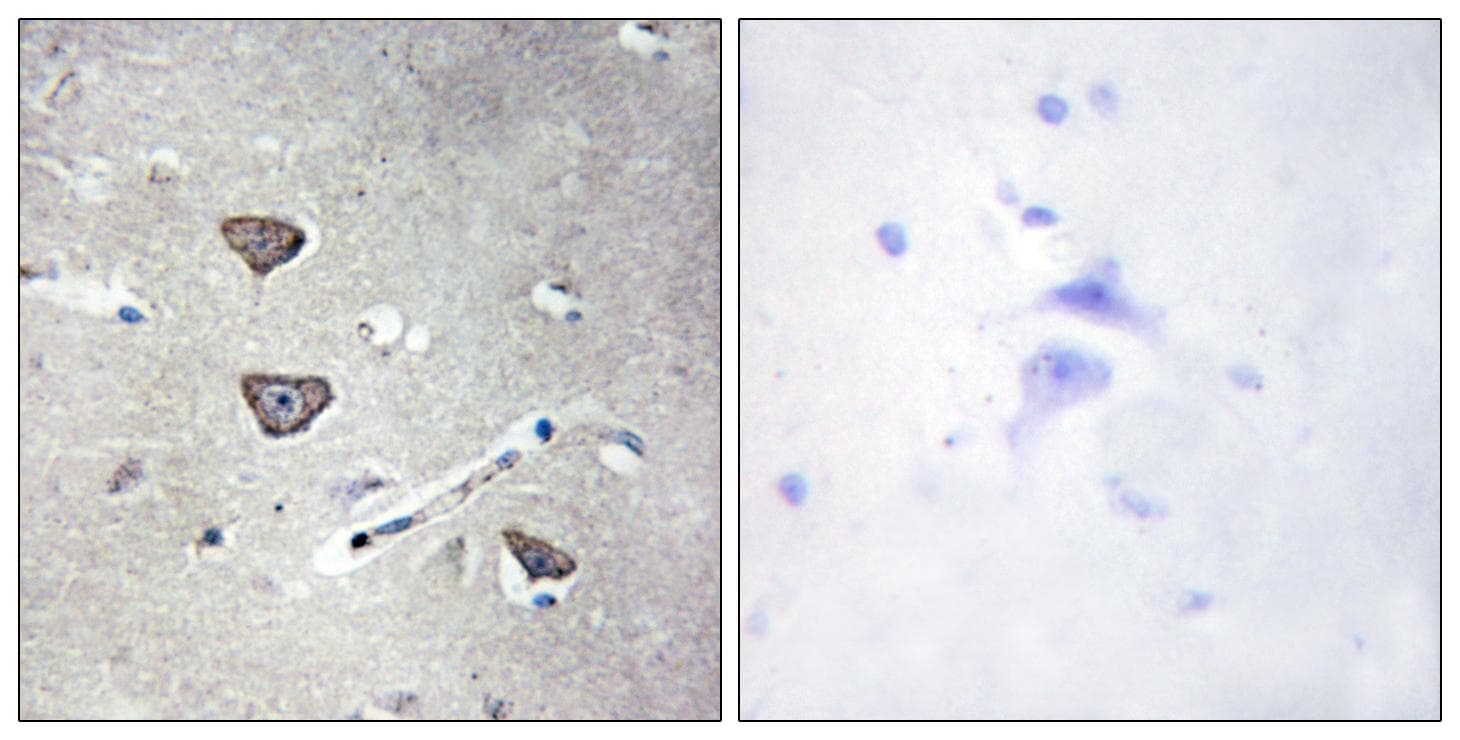 HTR2C / 5-HT2C Receptor Antibody