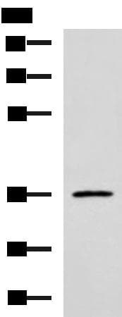 Polyclonal Rabbit anti-Human IBSP / Bone Sialoprotein Antibody (IHC, WB)