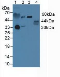 PRLR / Prolactin Receptor Antibody (aa25-234)