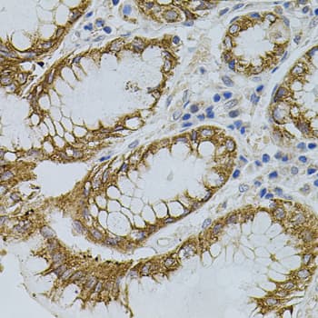 IHC-plus™ Polyclonal Rabbit anti-Human OPRS1 / SIGMAR1 Antibody (IHC, WB)