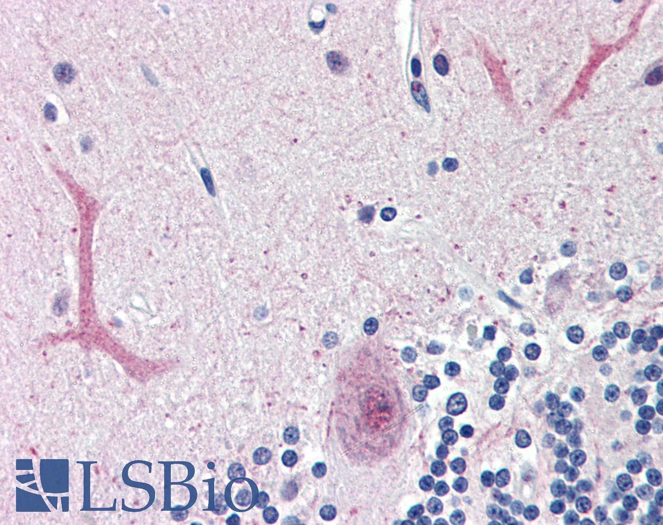 PathPlus™ FOXC1 Antibody (aa541-553)