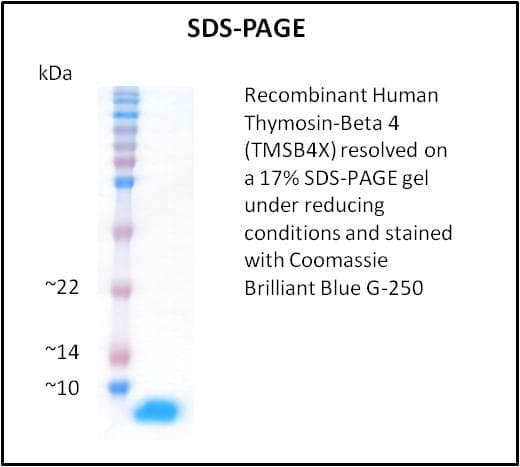 Human TMSB4X / Thymosin Beta-4 Protein (Recombinant)