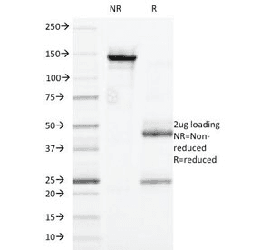 FCGR2 / CD32 Antibody (clone 7.3)