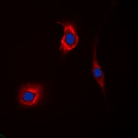 GAK Antibody (N-Terminus)