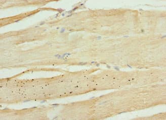 Polyclonal Rabbit anti-Human KIF1B / CMT2 Antibody (IHC)
