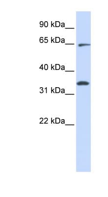 Polyclonal Rabbit anti-Human RHOT1 Antibody (aa396-445, WB)