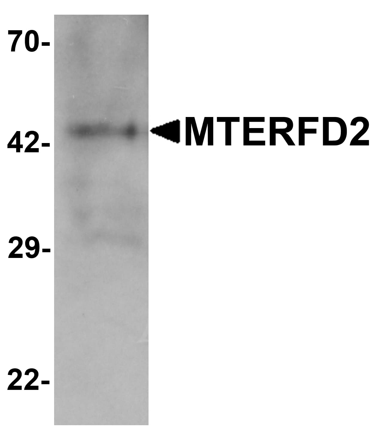 MTERF4 / MTERFD2 Antibody