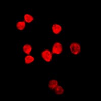TDG / Thymine DNA Glycosylase Antibody (Internal)