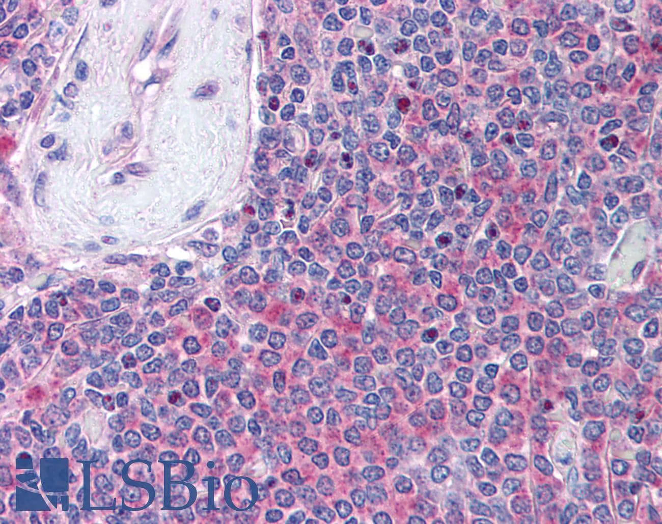 IHC-plus™ UBASH3A / CLIP4 Antibody (aa417-430)