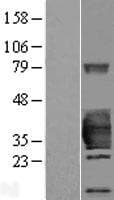 HSD17B14 Protein (Over-Expression Lysate Myc-DDK (Flag))