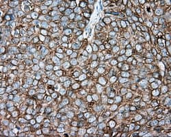 TUBA8 / Tubulin Alpha 8 Antibody (clone OTI2G6, Carrier-free)